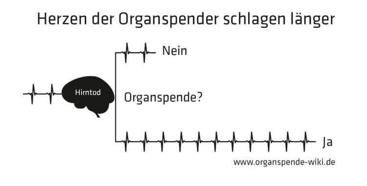 Schaubild von Pater Schäfer zur Organspende